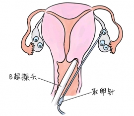幼儿学画画，厦门捐卵宝宝学画画，学画画的好处，如何学画画