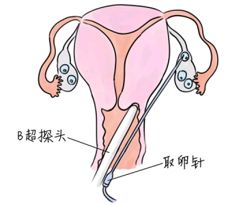 幼儿学画画，厦门捐卵宝宝学画画，学画画的好处，如何学画画